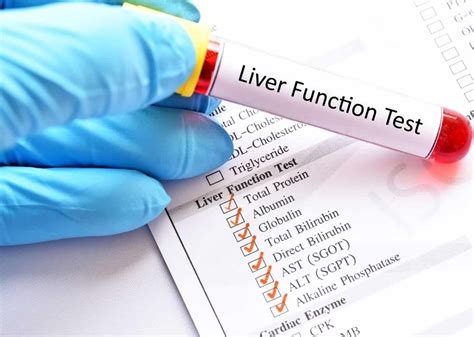 liver soft tissue test|blood test for liver disease.